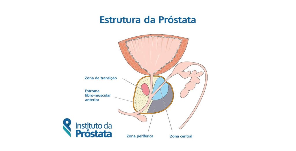 zona do cancer de prostata zona periférica tem maior incidência de câncer de próstata