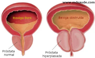 Bora testar este update! - JOGATINA HPB 